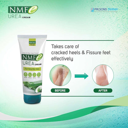 NMFe Urea Cream 150 gm